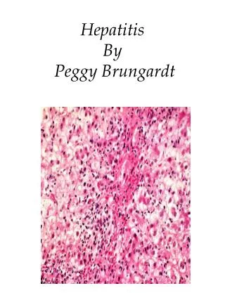 Hepatitis By Peggy Brungardt