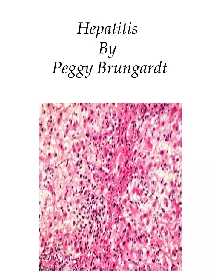 hepatitis by peggy brungardt