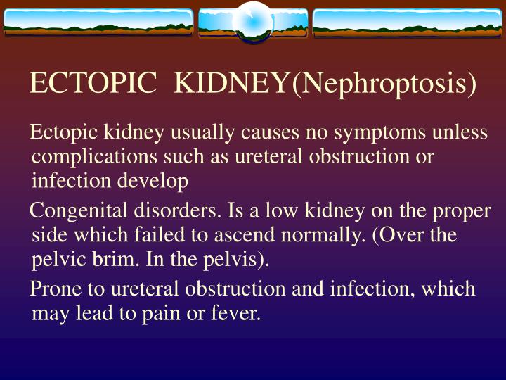 ectopic kidney nephroptosis