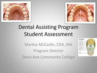 Dental Assisting Program Student Assessment