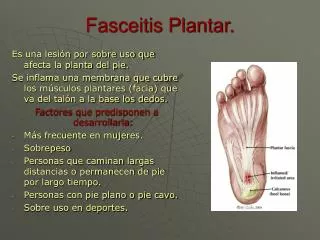 fasceitis plantar