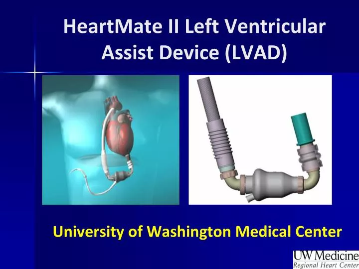 heartmate ii left ventricular assist device lvad