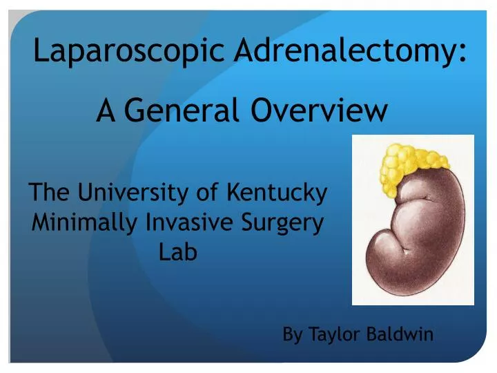 laparoscopic adrenalectomy