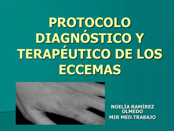 protocolo diagn stico y terap utico de los eccemas