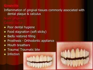 Gingivitis Inflammation of gingival tissues commonly associated with dental plaque &amp; calculus Acute gingivitis Caus