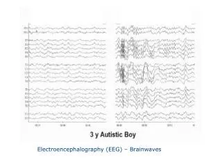 Electroencephalography (EEG) – Brainwaves