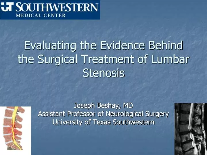 evaluating the evidence behind the surgical treatment of lumbar stenosis