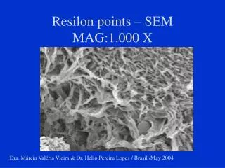 Resilon points – SEM MAG:1.000 X