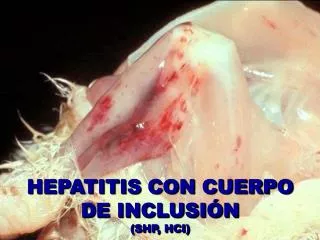 hepatitis con cuerpo de inclusi n shp hci