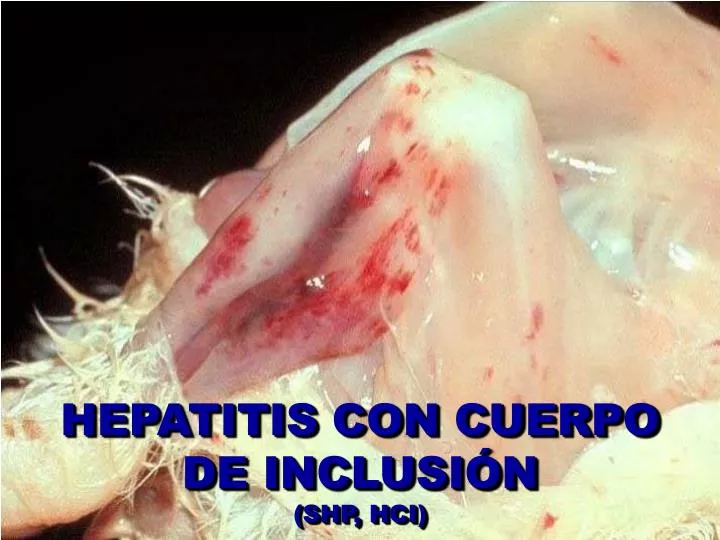 hepatitis con cuerpo de inclusi n shp hci