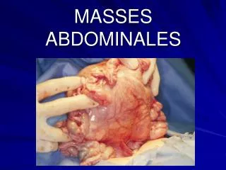 masses abdominales