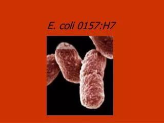 E. coli 0157:H7
