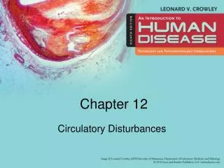 Circulatory Disturbances
