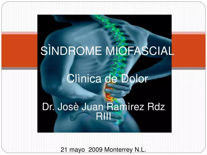 s ndrome miofascial cl nica de dolor