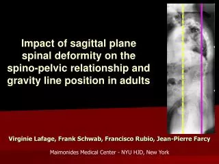 Impact of sagittal plane spinal deformity on the spino-pelvic relationship and gravity line position in adults