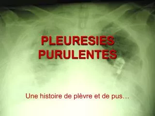pleuresies purulentes