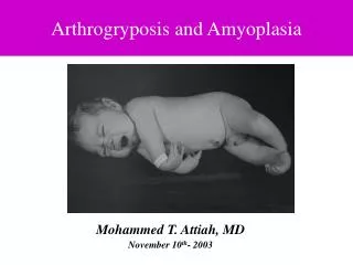 Arthrogryposis and Amyoplasia