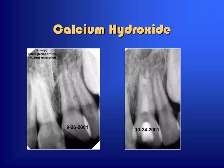 calcium hydroxide