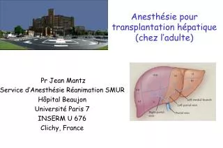 Anesthésie pour transplantation hépatique (chez l’adulte)