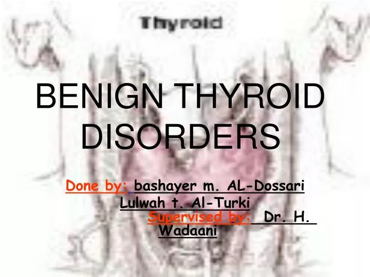 benign thyroid disorders