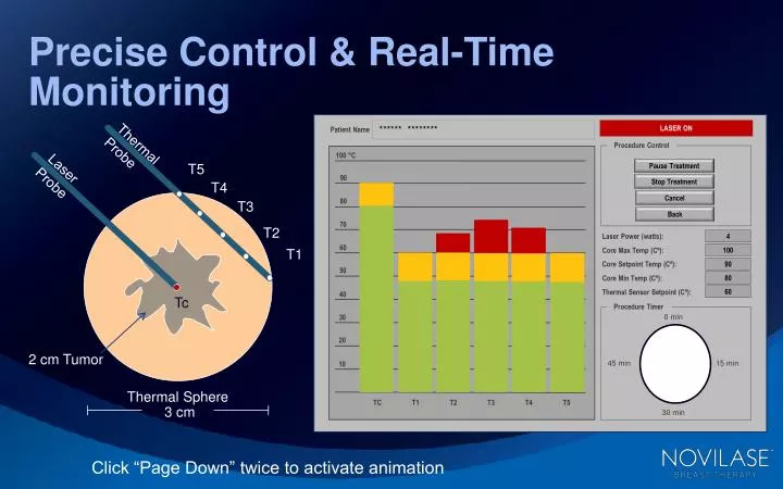 precise control real time monitoring