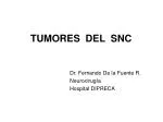 TUMORES DEL SNC - slide 1