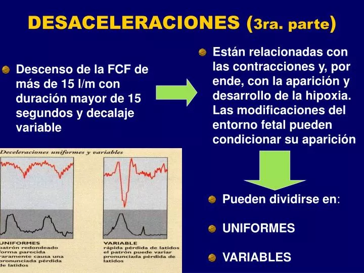 desaceleraciones 3ra parte