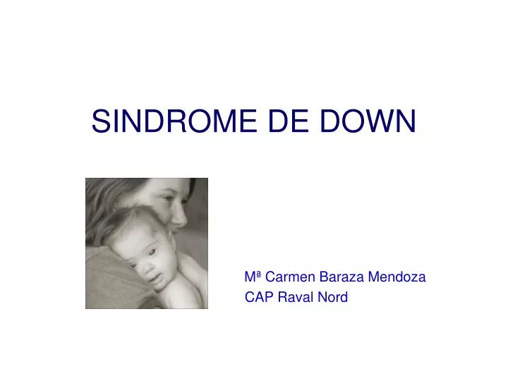 sindrome de down