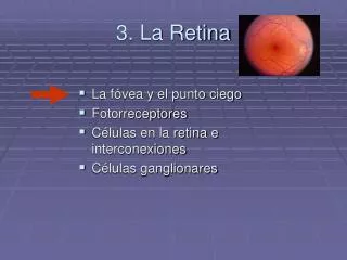 3. La Retina