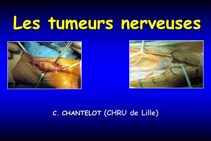 les tumeurs nerveuses