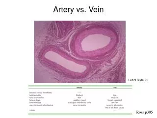 Artery vs. Vein