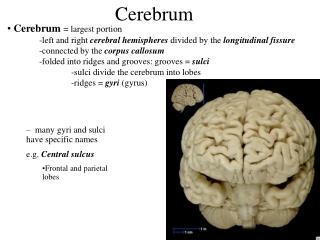 Cerebrum = largest portion 	-left and right cerebral hemispheres divided by the longitudinal fissure 	-connected by t
