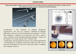 endoscopio