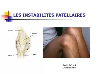 les instabilites patellaires