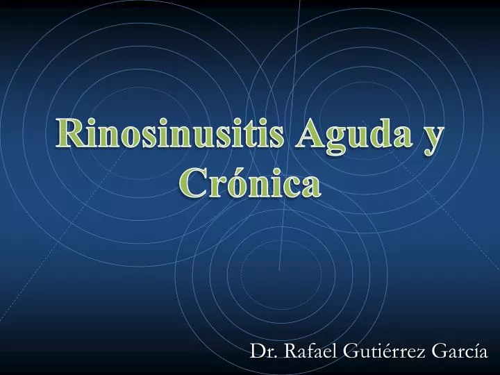 rinosinusitis aguda y cr nica