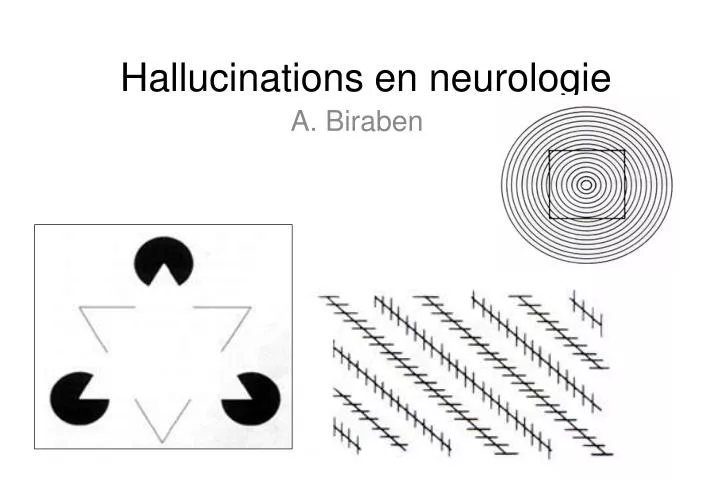 hallucinations en neurologie