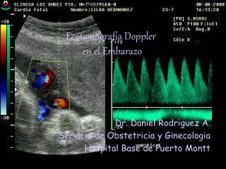 Ecotomografia Doppler en el Embarazo