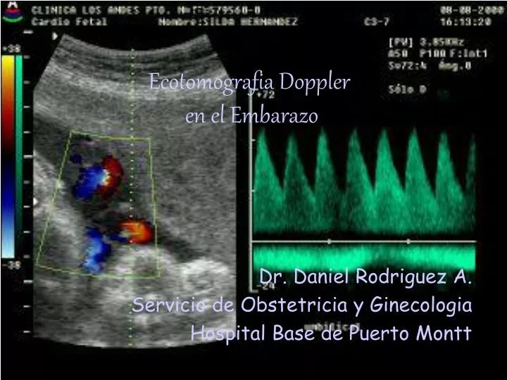 ecotomografia doppler en el embarazo