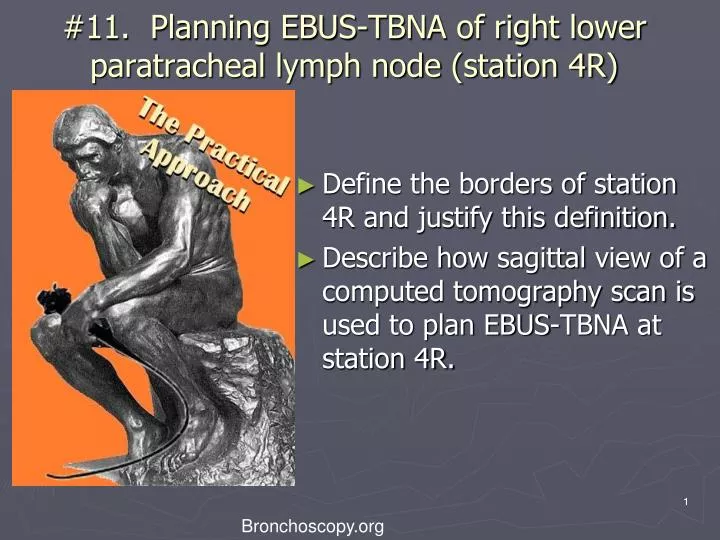 11 planning ebus tbna of right lower paratracheal lymph node station 4r