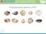 Frontotemporal demens (FTD) - slide 1