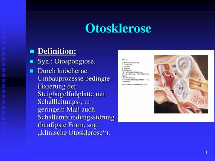 otosklerose