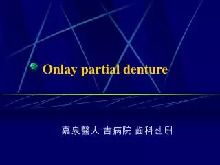 Onlay partial denture