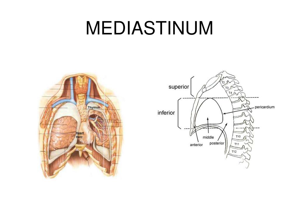 PPT - MEDIASTINUM PowerPoint Presentation, free download - ID:891612