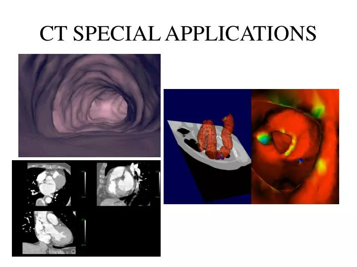 ct special applications