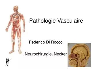federico di rocco neurochirurgie necker