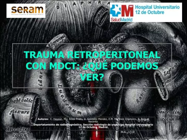 trauma retroperitoneal con mdct qu podemos ver