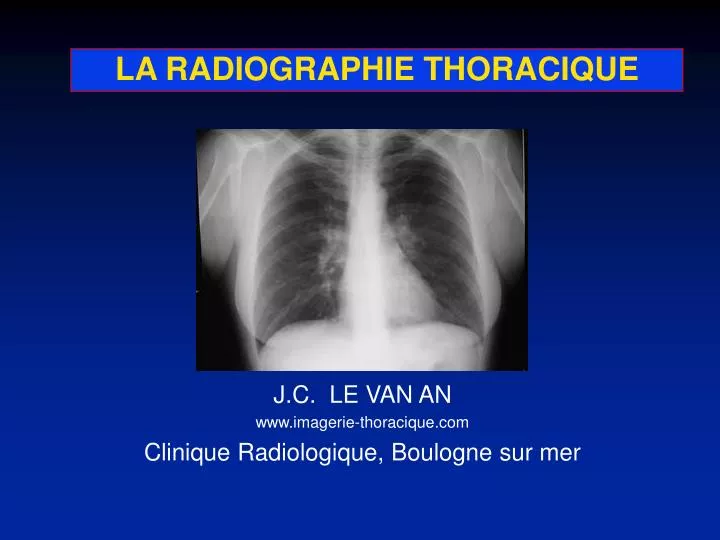 la radiographie thoracique