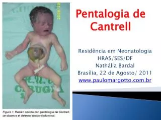 Residência em Neonatologia HRAS/SES/DF Nathália Bardal Brasília, 22 de Agosto/ 2011 www.paulomargotto.com.br
