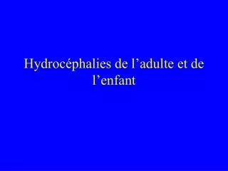 hydroc phalies de l adulte et de l enfant
