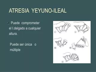 atresia yeyuno ileal